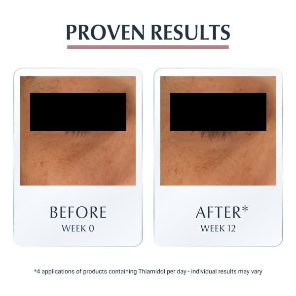 Dark Circles Under Eyes Eucerin UK